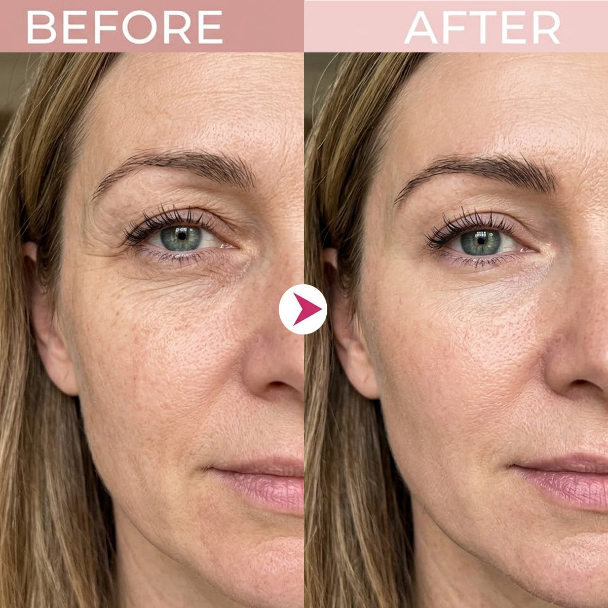 💖Trusted-by-over-50-000-women💖 Eye Renewal Crème